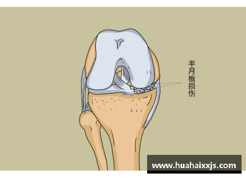 优发国际随优而动一触即发足球星辰的韧性之旅 半月板损伤如何改变了他们的职业生涯